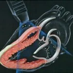 Revisión de Políticas: ¿Están los Hogares Geriátricos de Medellín Preparados para Emergencias Cardíacas?