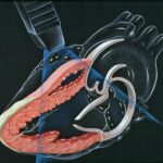 Prevención y Manejo de la Insuficiencia Cardíaca en Adultos Mayores: Una Guía Esencial