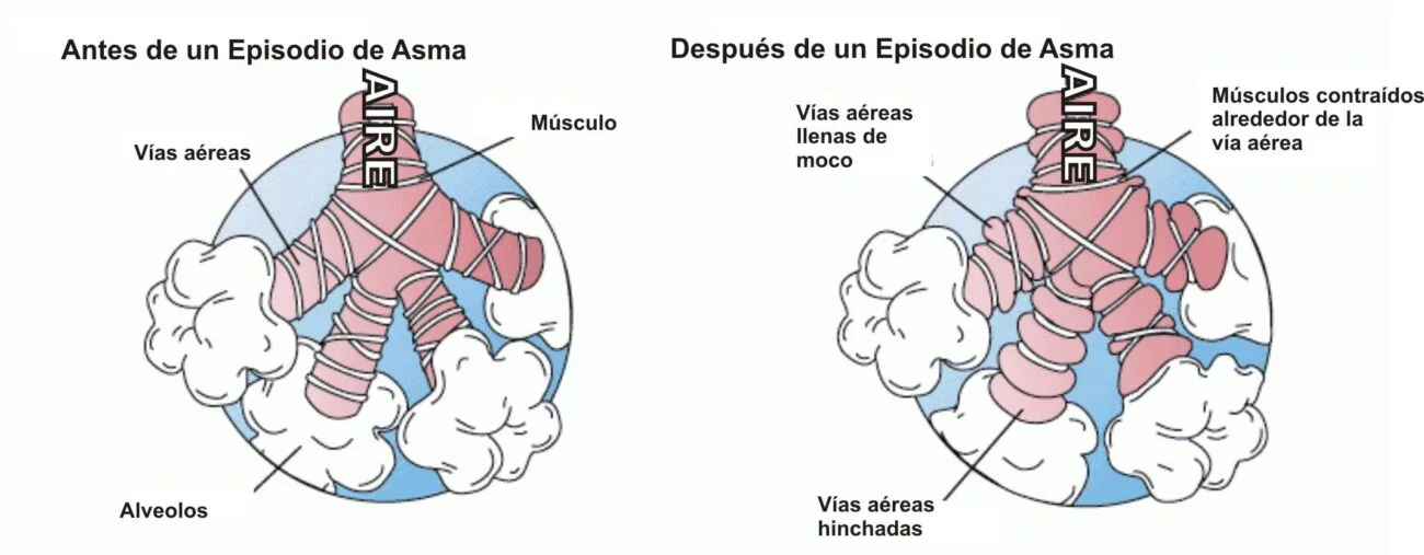 Reseña de las mejores prácticas de limpieza para reducir alérgenos en hogares geriátricos.