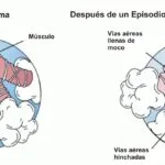 Reseña de las mejores prácticas de limpieza para reducir alérgenos en hogares geriátricos.