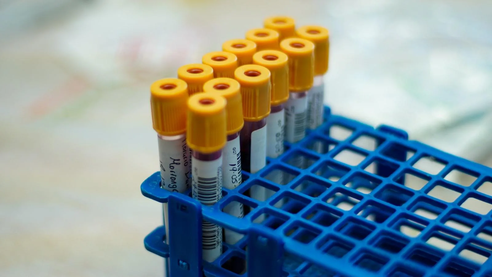 Recomendaciones específicas para integrar la medicina alternativa en el tratamiento convencional de la insuficiencia cardíaca