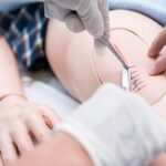 Los médicos recomiendan terapias físicas para personas con Corea de Huntington en geriátricos de Medellín