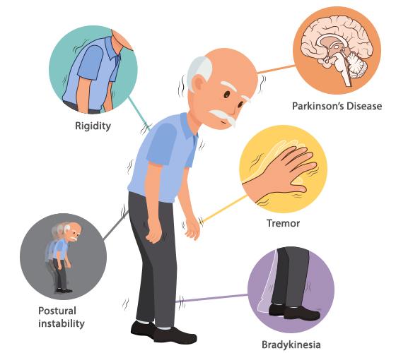 Importancia de un enfoque holístico en el tratamiento del Parkinson