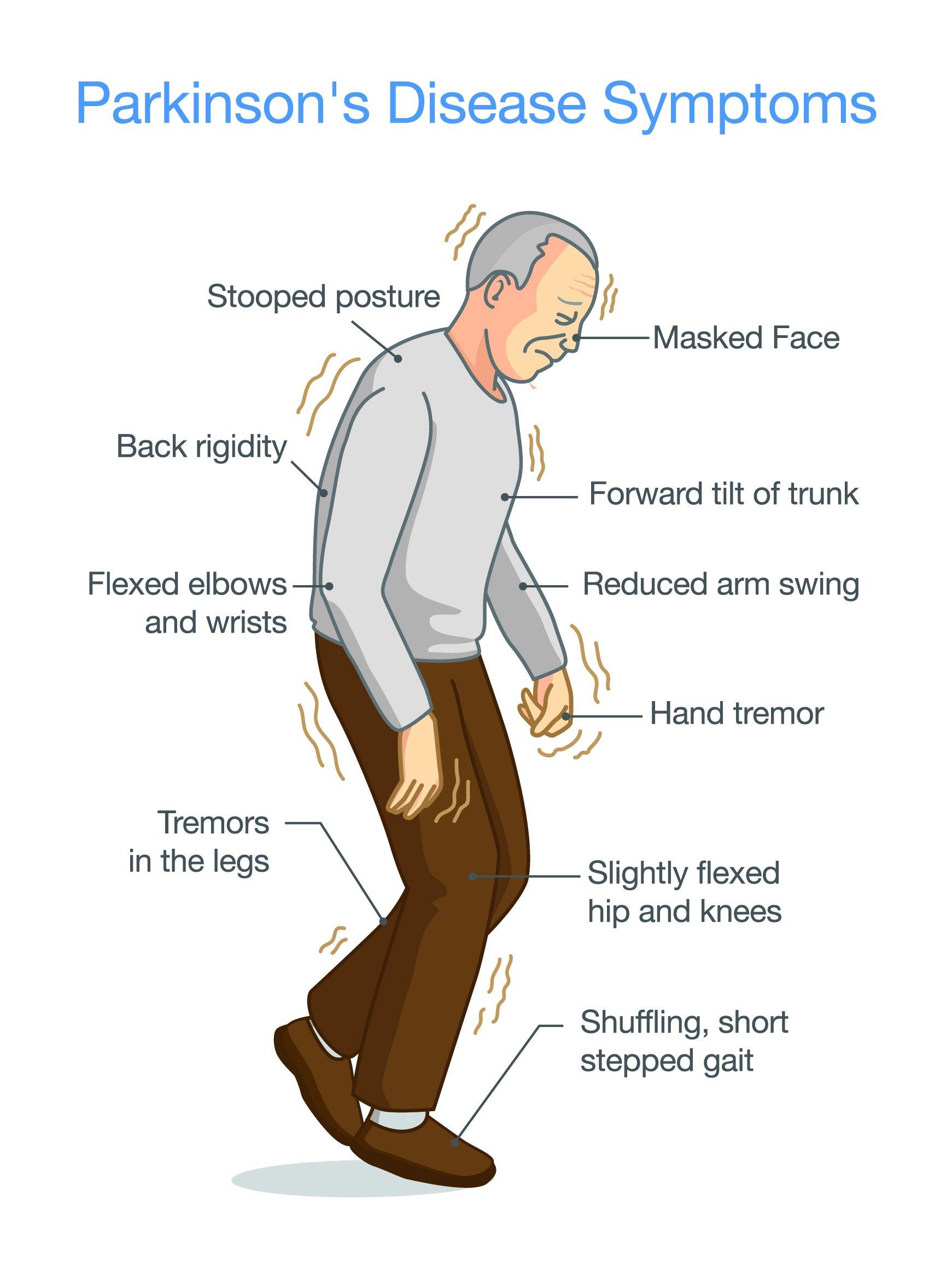 Recomendaciones para mejorar la calidad de vida de pacientes con Parkinson en hogares geriátricos