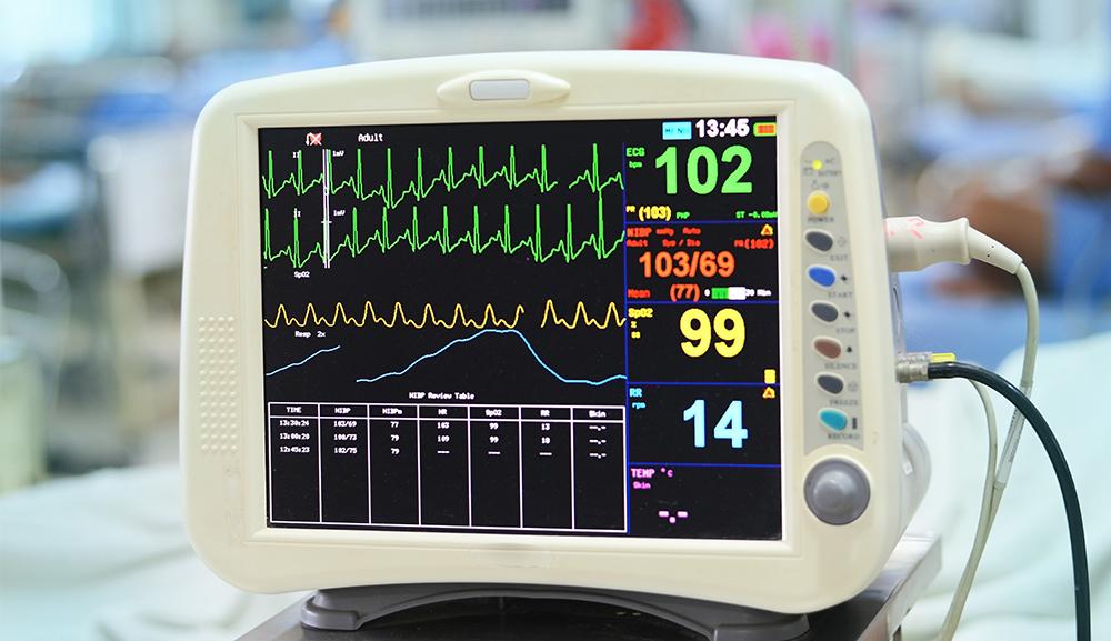 Importancia del monitoreo cardíaco continuo en pacientes geriátricos